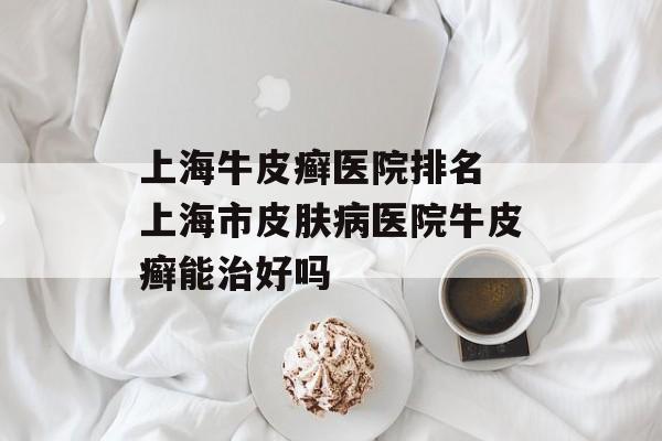 上海牛皮癣医院排名 上海市皮肤病医院牛皮癣能治好吗-第1张图片-